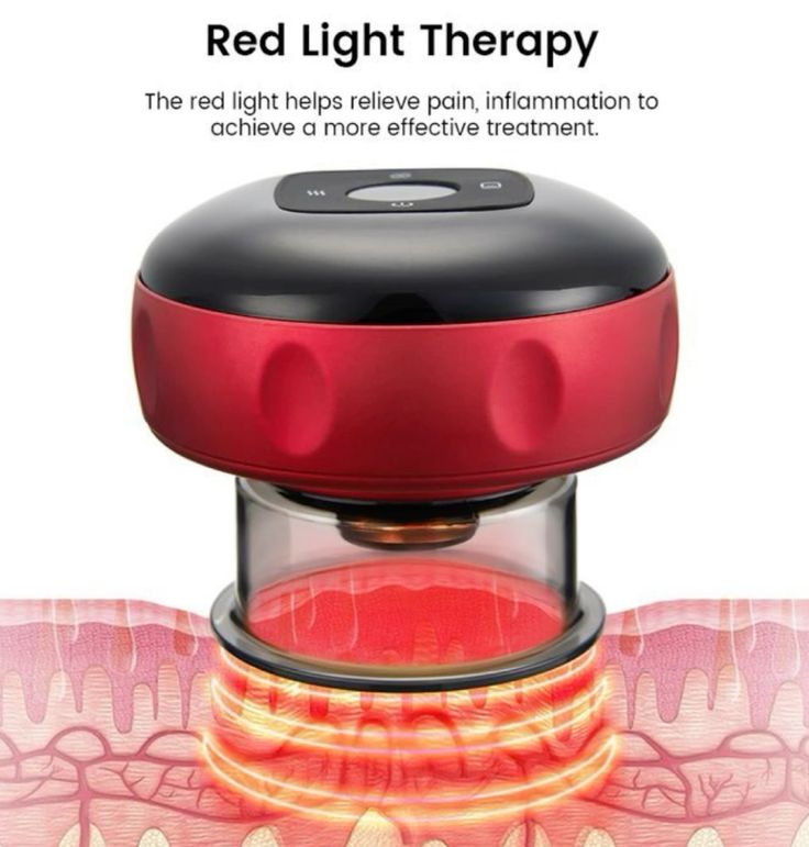 Smart Electric Vacuum Suction Scraping Therapy Massager